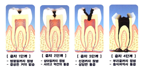 이미지명