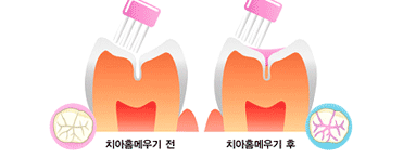 이미지명